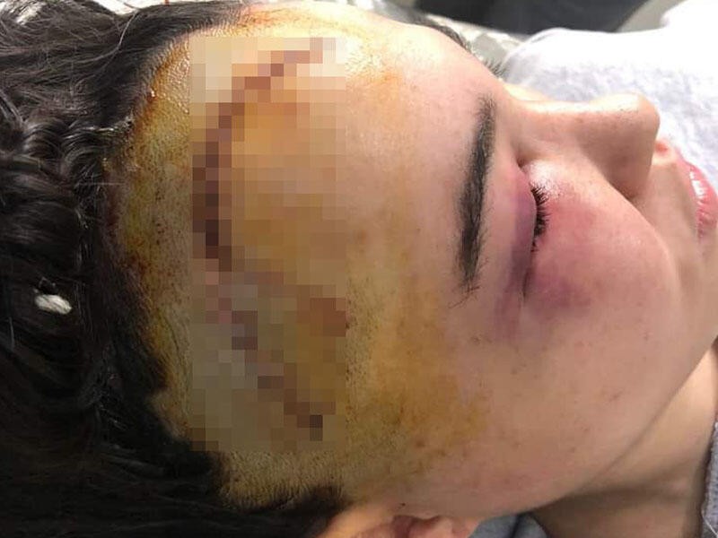 Küləkli havada “Tarqovı”da başına daş düşdü, müalicəsini edən yoxdur- FOTO