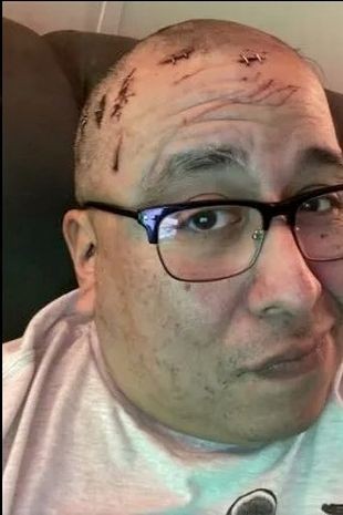 Hakimi bıçaqlayan güləşçi yarışlardankənarlaşdırıldı (FOTOLAR)