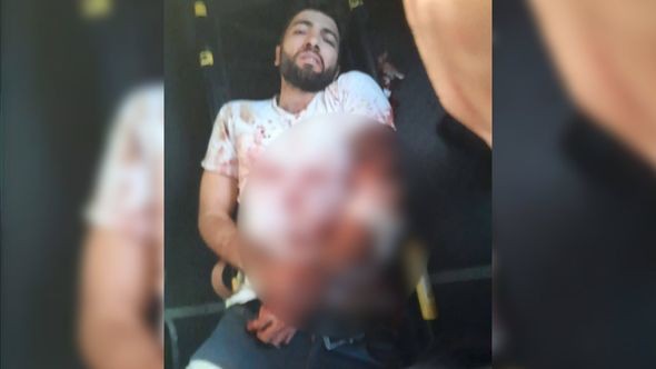 Ermənilərin yaraladığı şəxslə bağlıRƏSMİ AÇIQLAMA - YENİLƏNİB (FOTOLAR)