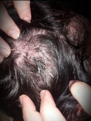 15 yaşında ərə verilən qız həyat yoldaşı və qayınanası tərəfindəndöyülürmüş - FOTO