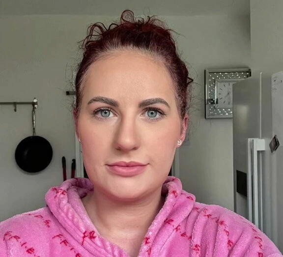 Buxağını kiçiltmək istədi, üzü dörd dəfə böyüdü- FOTOLAR