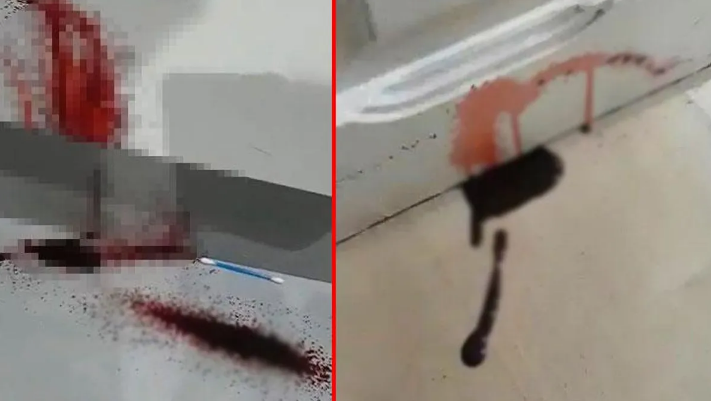 Kirayə tutduqları evin divarlarından QAN sızdı- Ölkə polisi təcili hərəkətə keçdi