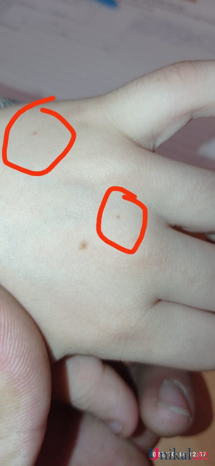 Azərbaycanda bu məktəbdə tükürpədici olay:İki azyaşlı şagirdə iynə vururmuşlar (ŞOK İDDİA)