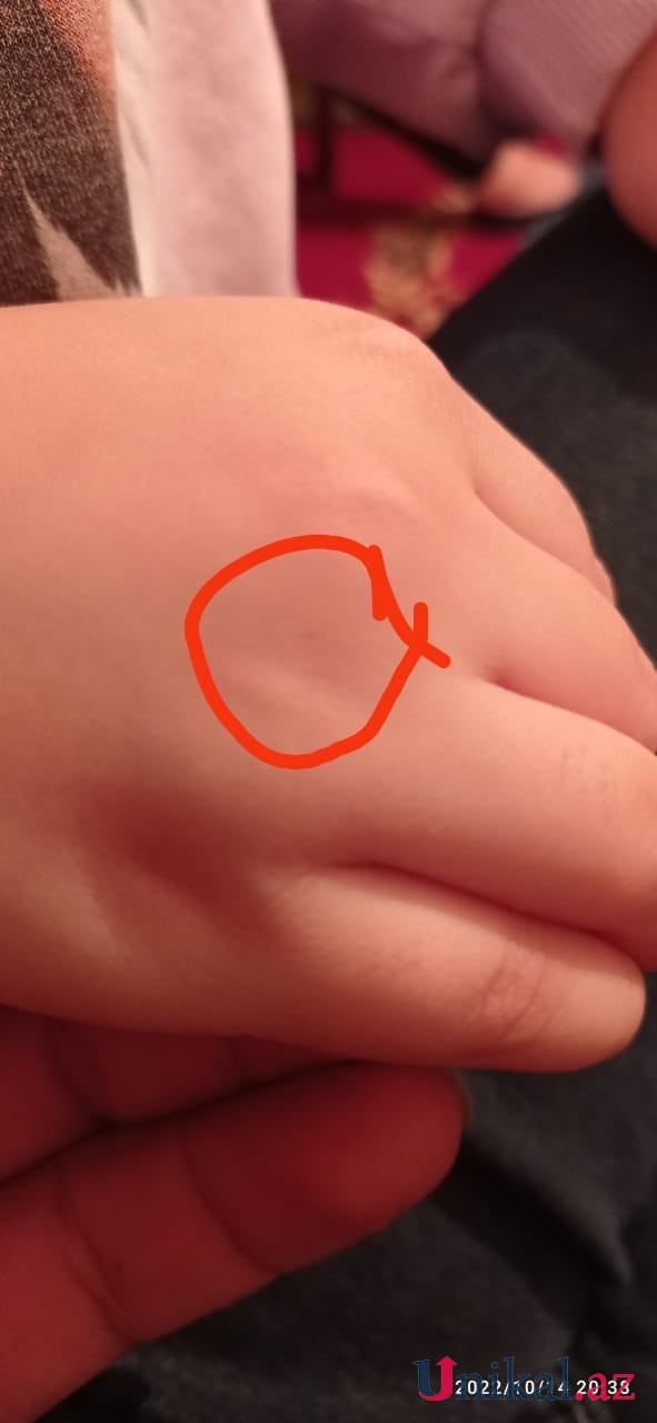 Azərbaycanda bu məktəbdə tükürpədici olay:İki azyaşlı şagirdə iynə vururmuşlar (ŞOK İDDİA)