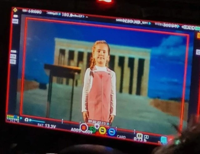 Reklamların tanınmış siması olan uşaq vəfat etdi- FOTOLAR