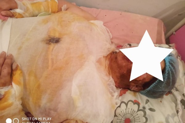 DƏHŞƏTLİ OLAY: Sevgilisi tərəfindən şiddət görən qadın görün nə etdi- FOTO