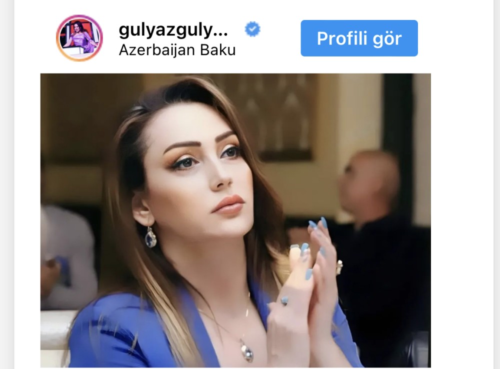 Gülyaz Məmmədova tanınmaz halda - FOTO