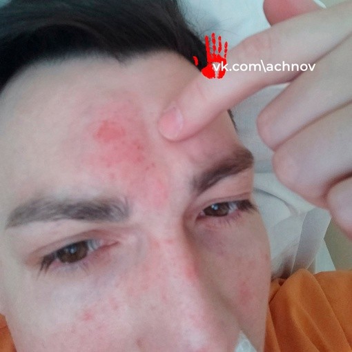 “Mercedes”in sürücüsü məşhur aktyorun kəlləsini sındırıb