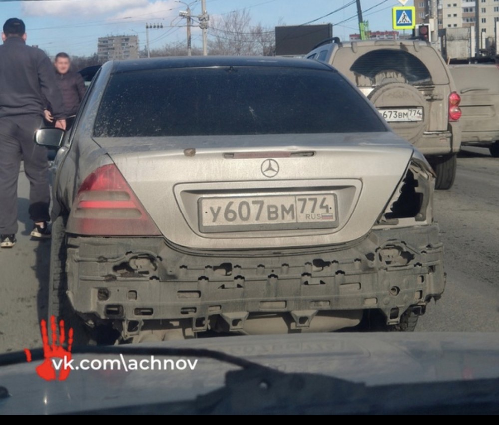 “Mercedes”in sürücüsü məşhur aktyorun kəlləsini sındırıb