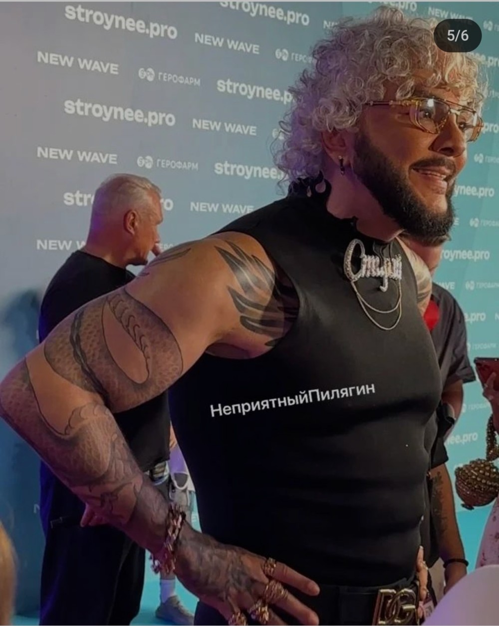 Filipp Kirkorov tənqid olundu- Həddən artıq plastik əməliyyat