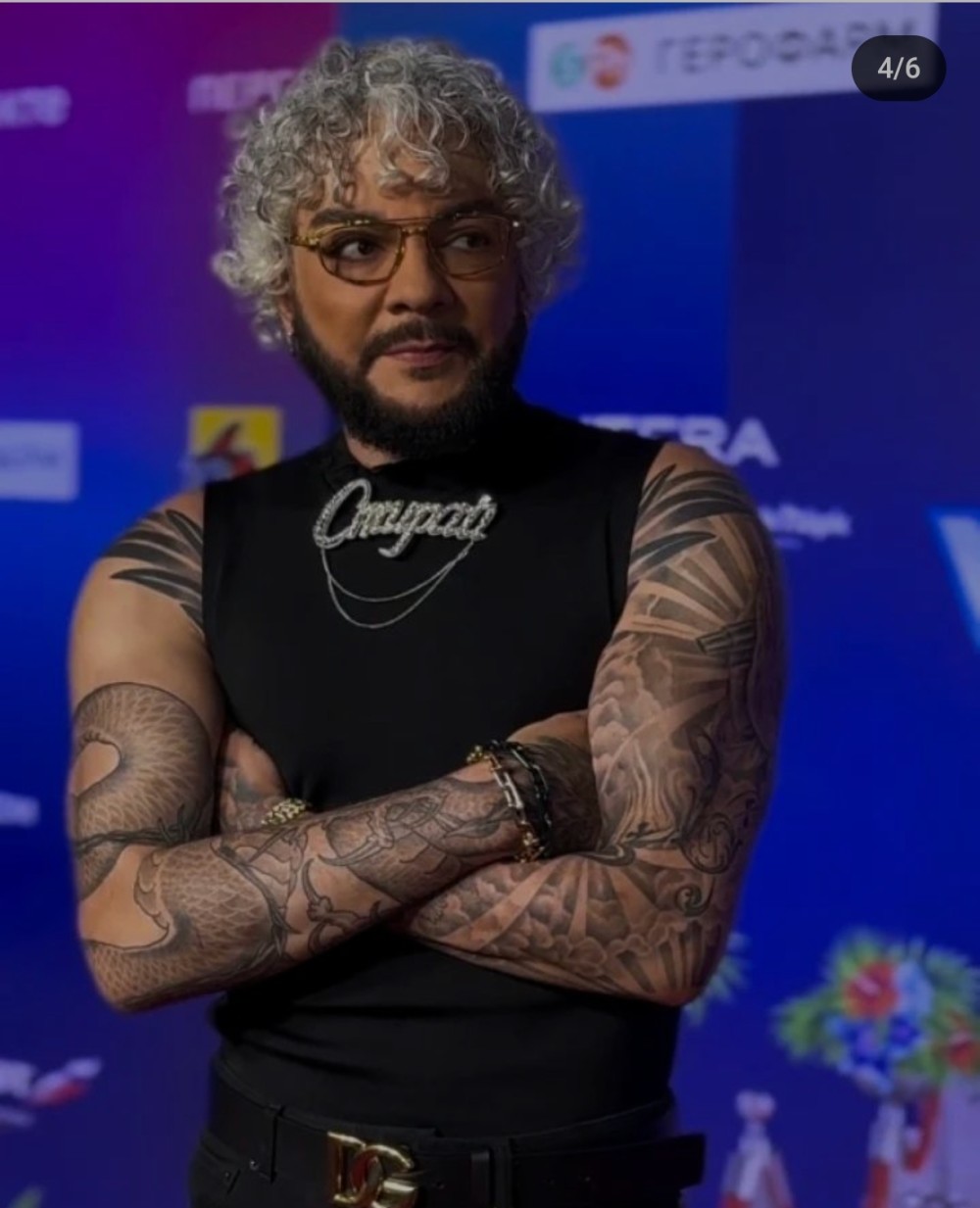 Filipp Kirkorov tənqid olundu- Həddən artıq plastik əməliyyat