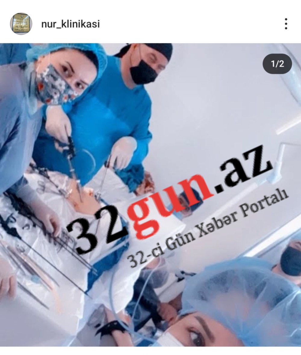 "Nur Klinika"nın dövlətə vergi borcu üzə çıxdı -Əməliyyat zamanı "pasientlər"lə yarıçılpaq "selfie"/ FOTOFAKT