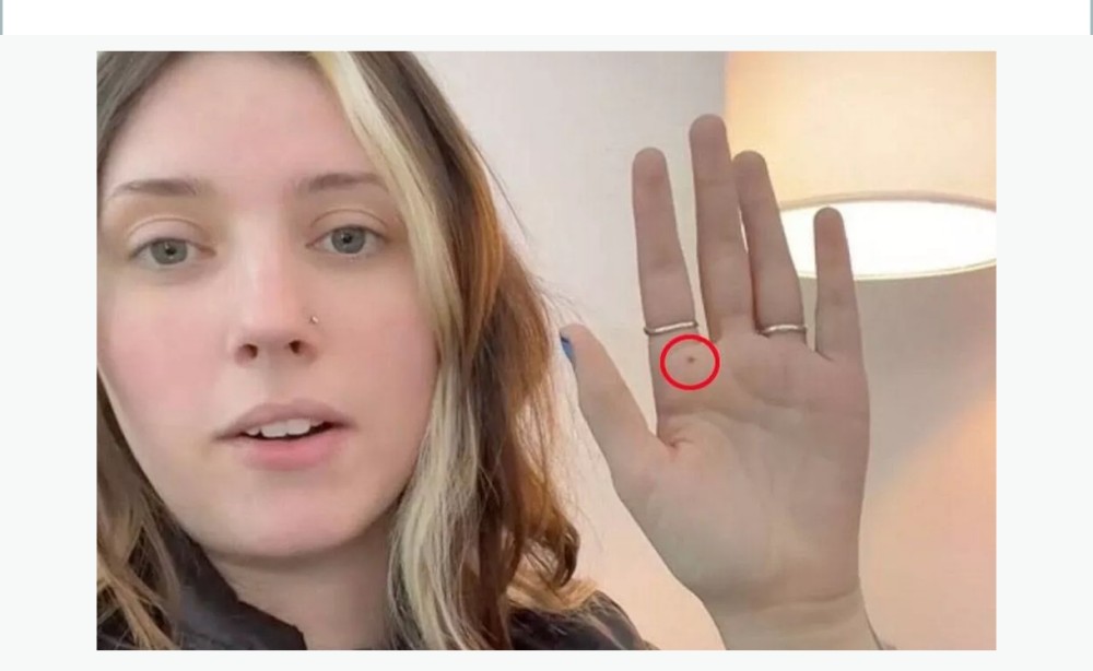 "ChatGPT" qadına fotodan əlini analiz etdikdən sonra təcili olaraq xəstəxanaya getməyi tövsiyə etdi