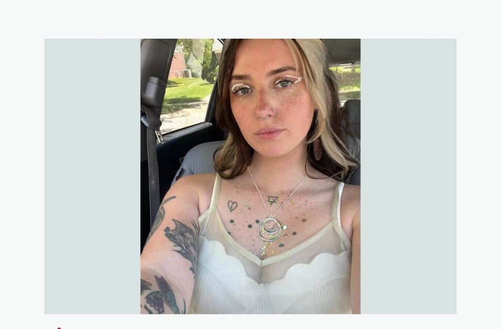 "ChatGPT" qadına fotodan əlini analiz etdikdən sonra təcili olaraq xəstəxanaya getməyi tövsiyə etdi