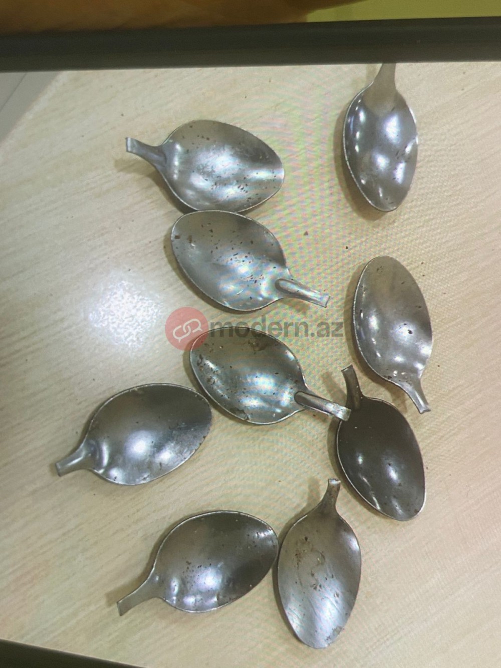 Bakı sakini 9 ədəd qaşıq uddu - FOTOLAR